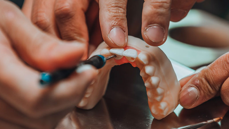 One lab technicians' hands grip a model of a top set of teeth while the other uses a tool to mark holes at the back of the two front teeth of the model.