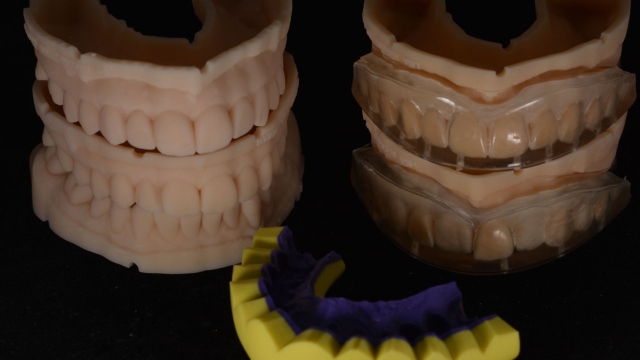 Four models of a set of teeth with gums, some models have a mould on top of the teeth.