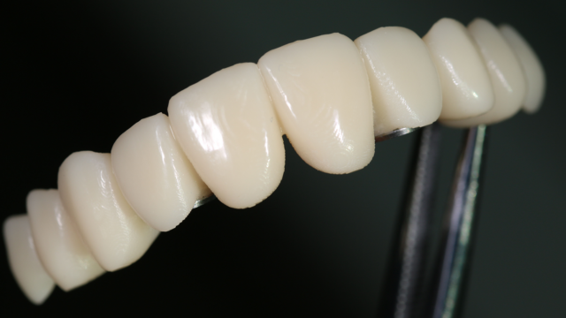 A top set of tooth prosphetics.