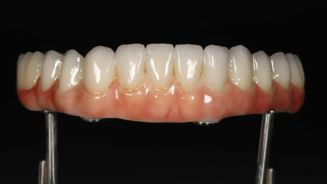 A set of prosphetic teeth with gums.