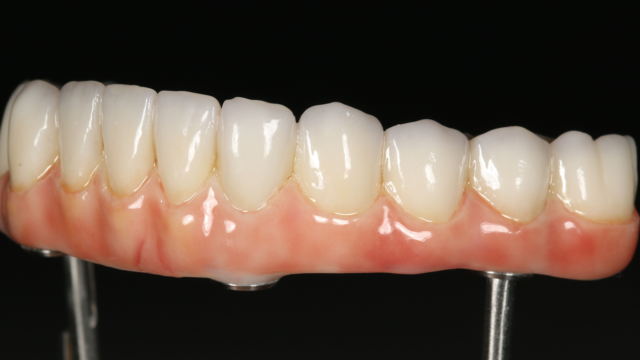 A set of prosphetic teeth with gums.